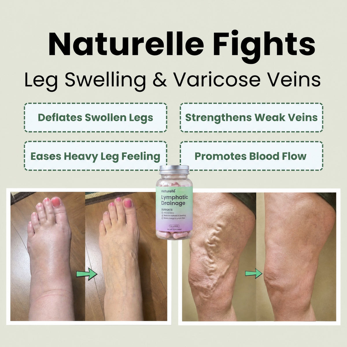 Naturelle Fights Leg Swelling & Varicose Veins
